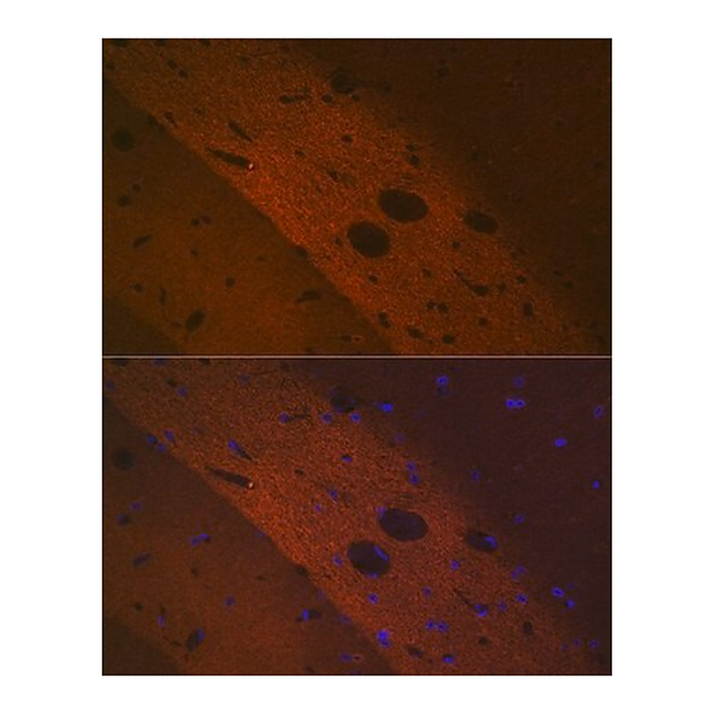 Merck Anti-mGluR2 antibody produced in rabbit