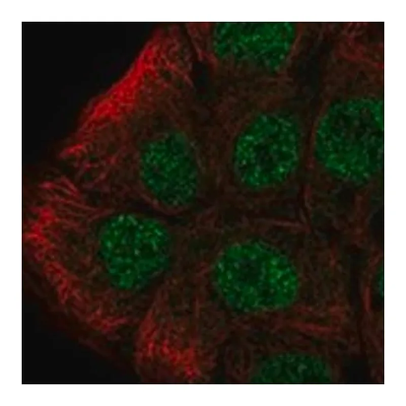 Merck Anti-TOP3B antibody produced in rabbit