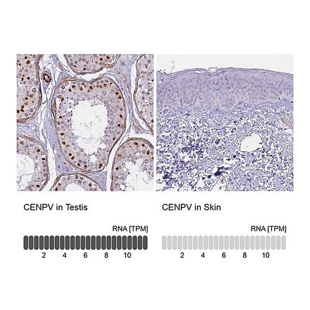 Merck Anti-CENPV antibody produced in rabbit