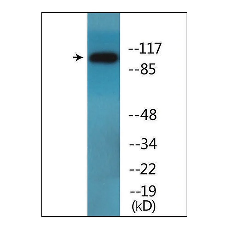 Merck Anti-phospho-DDR1 (pTyr513) antibody produced in rabbit
