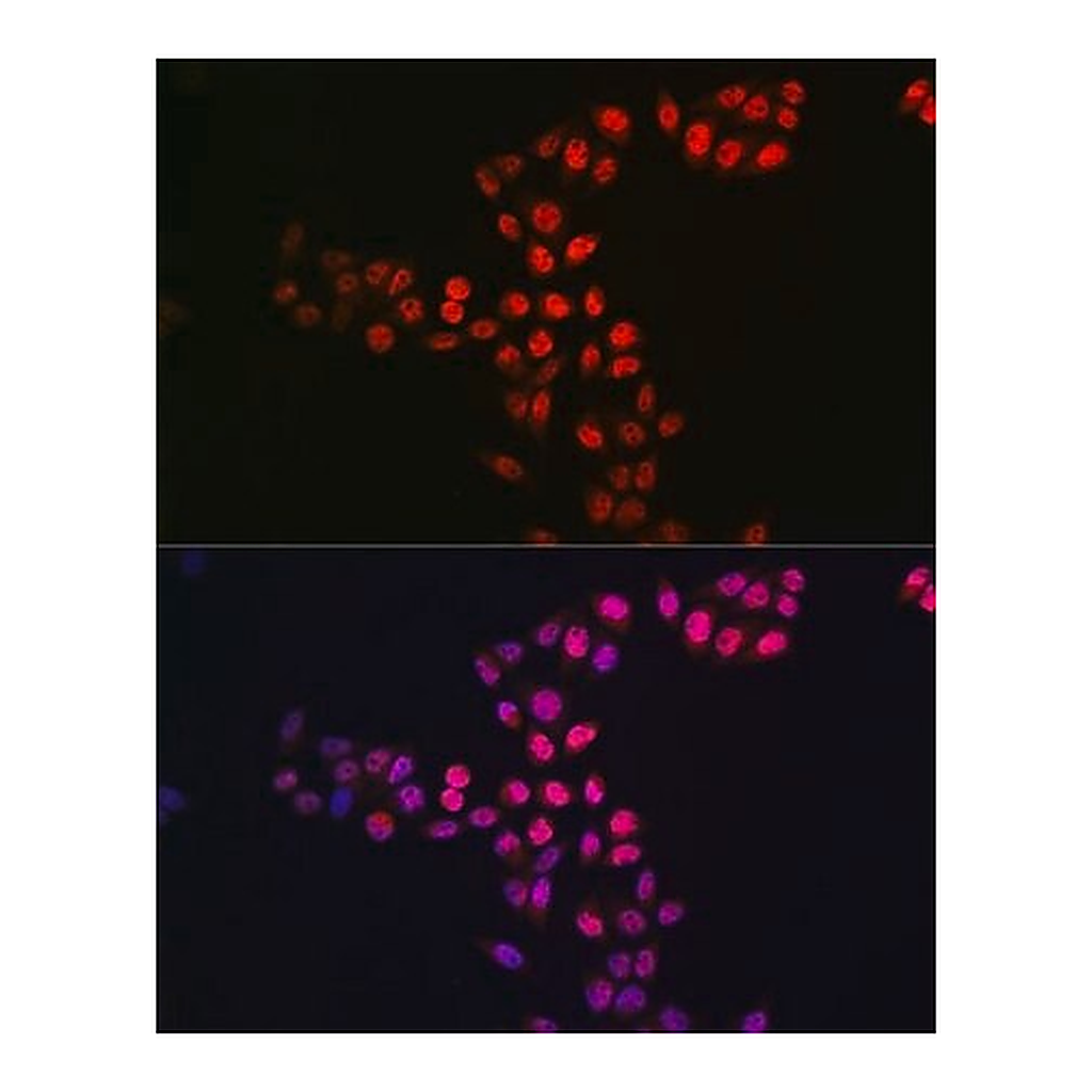 Merck Anti- SIRT1 antibody produced in rabbit