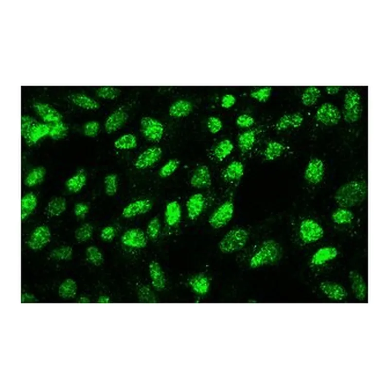 Merck MONOCLONAL ANTI-SUV39H1 HISTONE METHYLTR