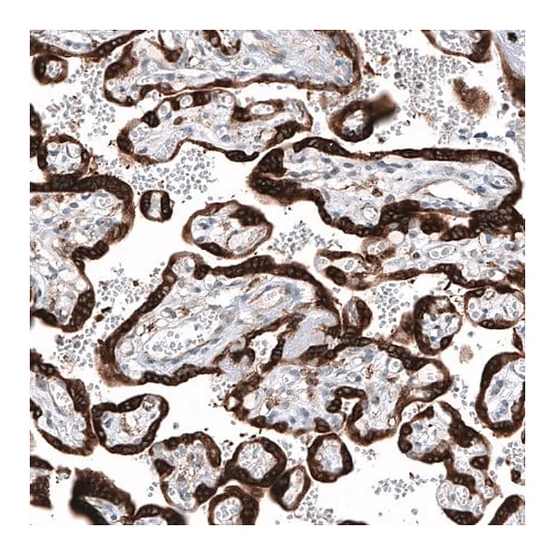 Merck Anti-IGF2BP3 antibody produced in rabbit