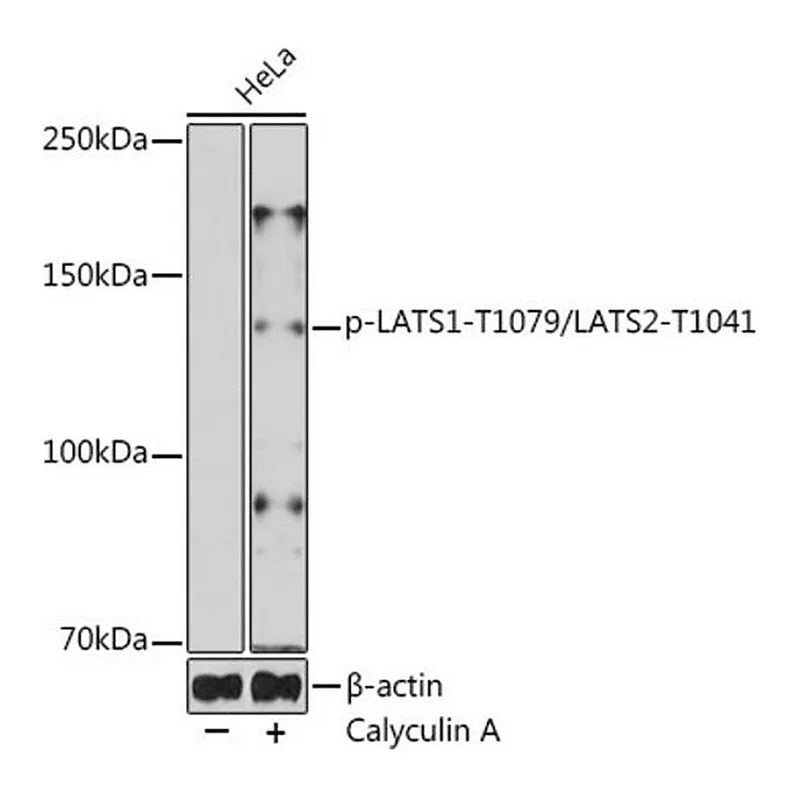 Merck Anti-phospho-LATS1-T1079/LATS2-T1041 antibody produced in rabbit