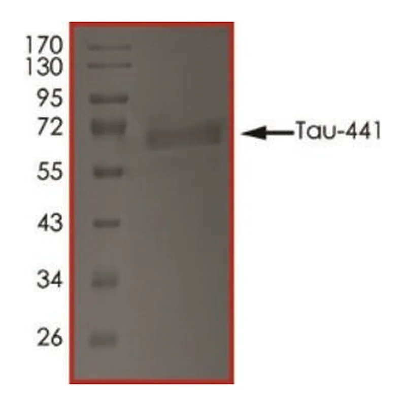 Merck TAU-441, TTBK1-PHOSPHORYLATED