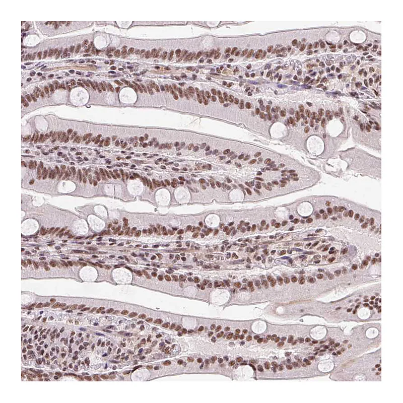 Atlas Antibodies Anti-DDX17 Antibody