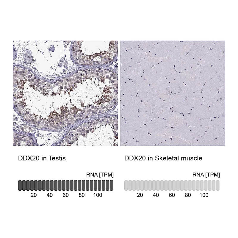Atlas Antibodies Anti-DDX20 Antibody