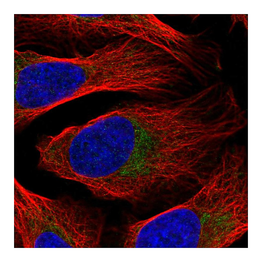 Atlas Antibodies Anti-DDX28 Antibody