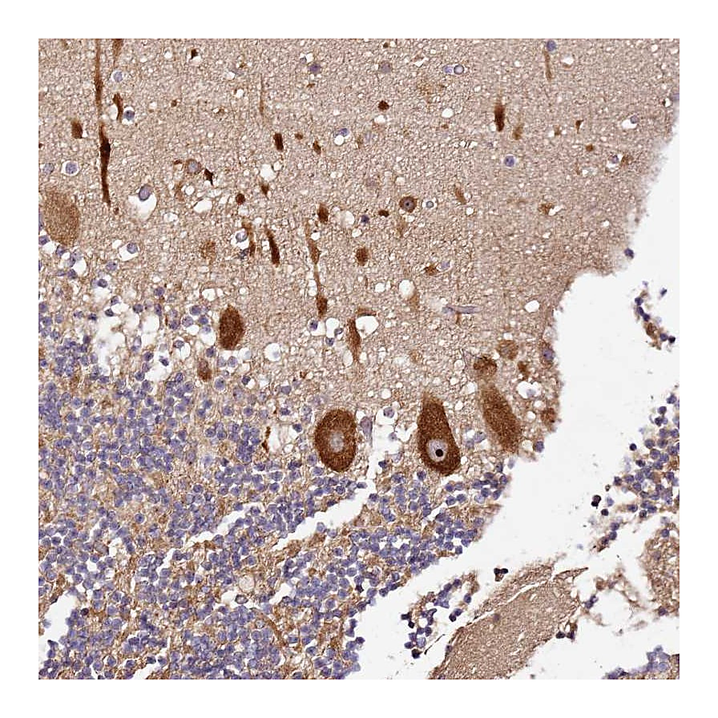 Atlas Antibodies Anti-DDX27 Antibody