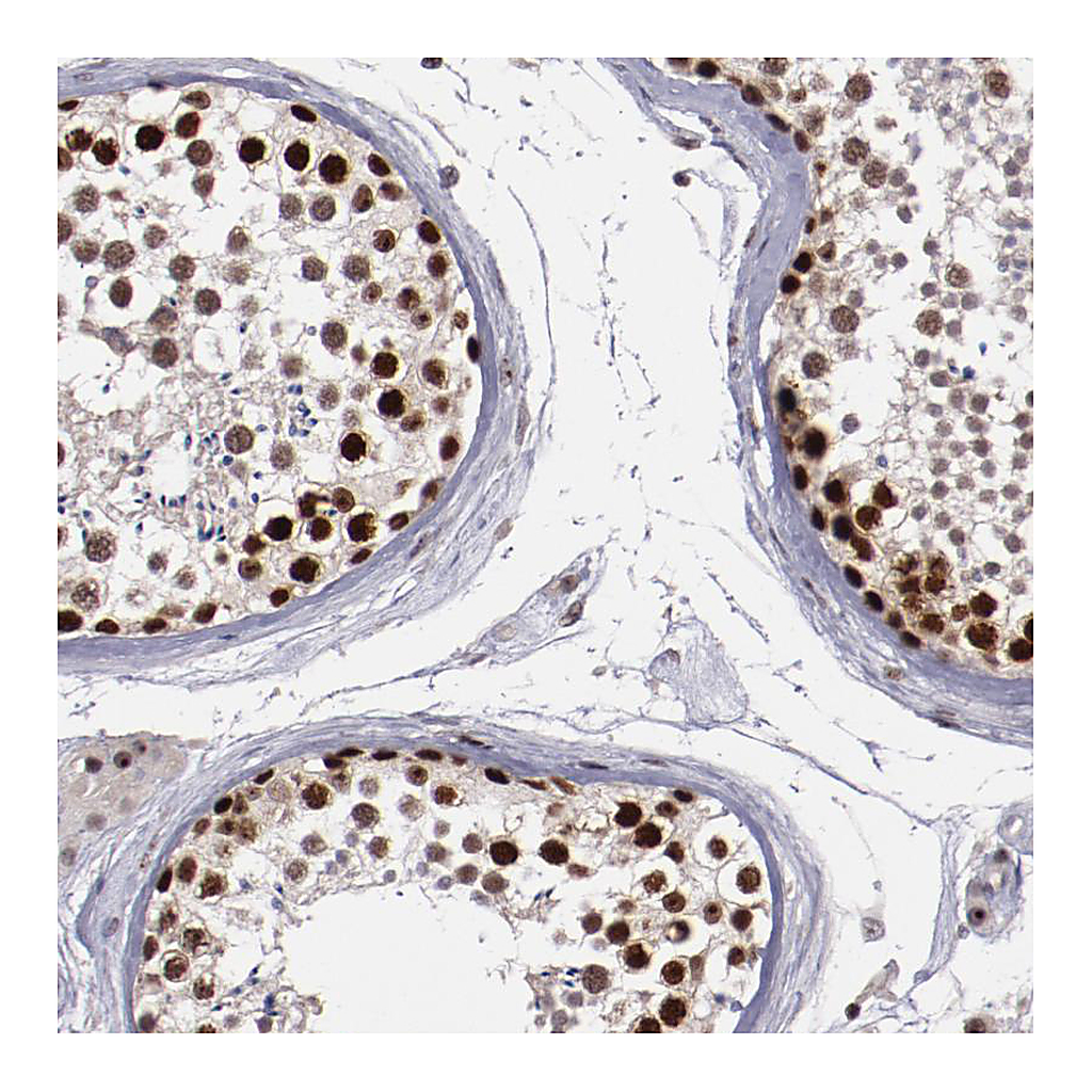 Atlas Antibodies Anti-DDX24 Antibody