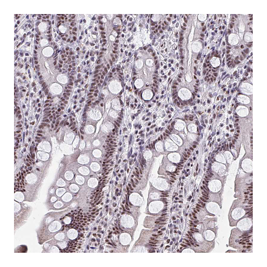 Atlas Antibodies Anti-DDX39B Antibody