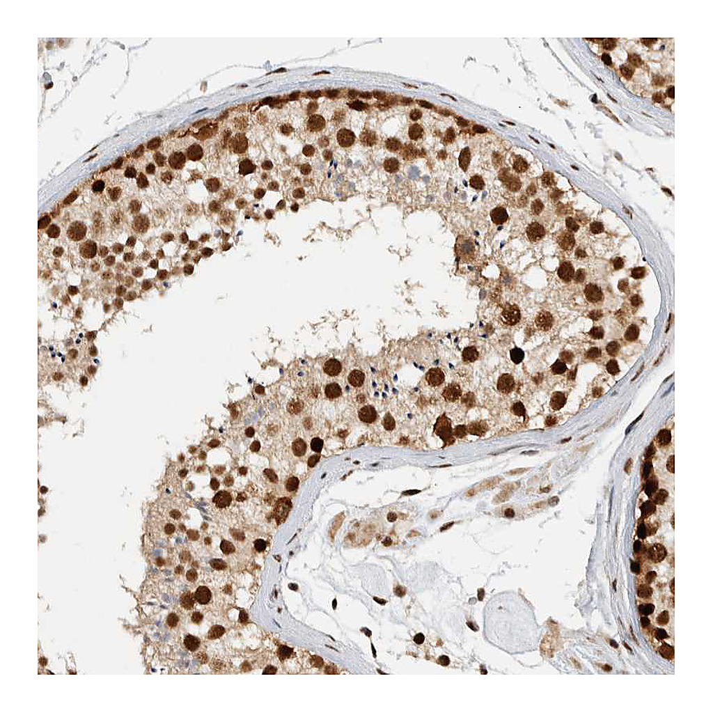Atlas Antibodies Anti-DDX42 Antibody