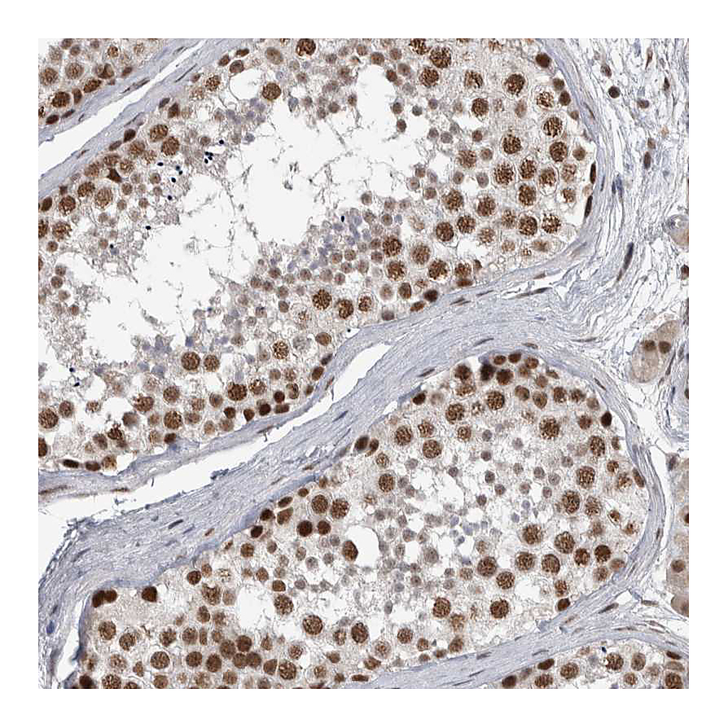 Atlas Antibodies Anti-DDX42 Antibody