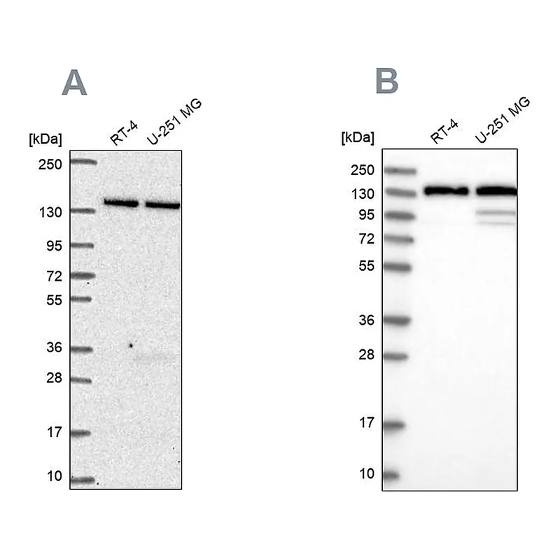 Atlas Antibodies Anti-DDX46 Antibody