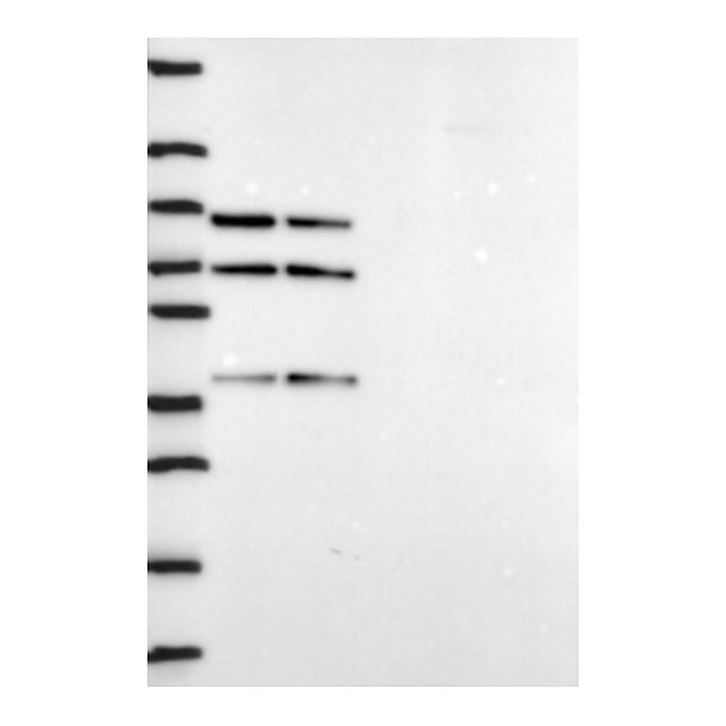 Atlas Antibodies Anti-DDX5 Antibody