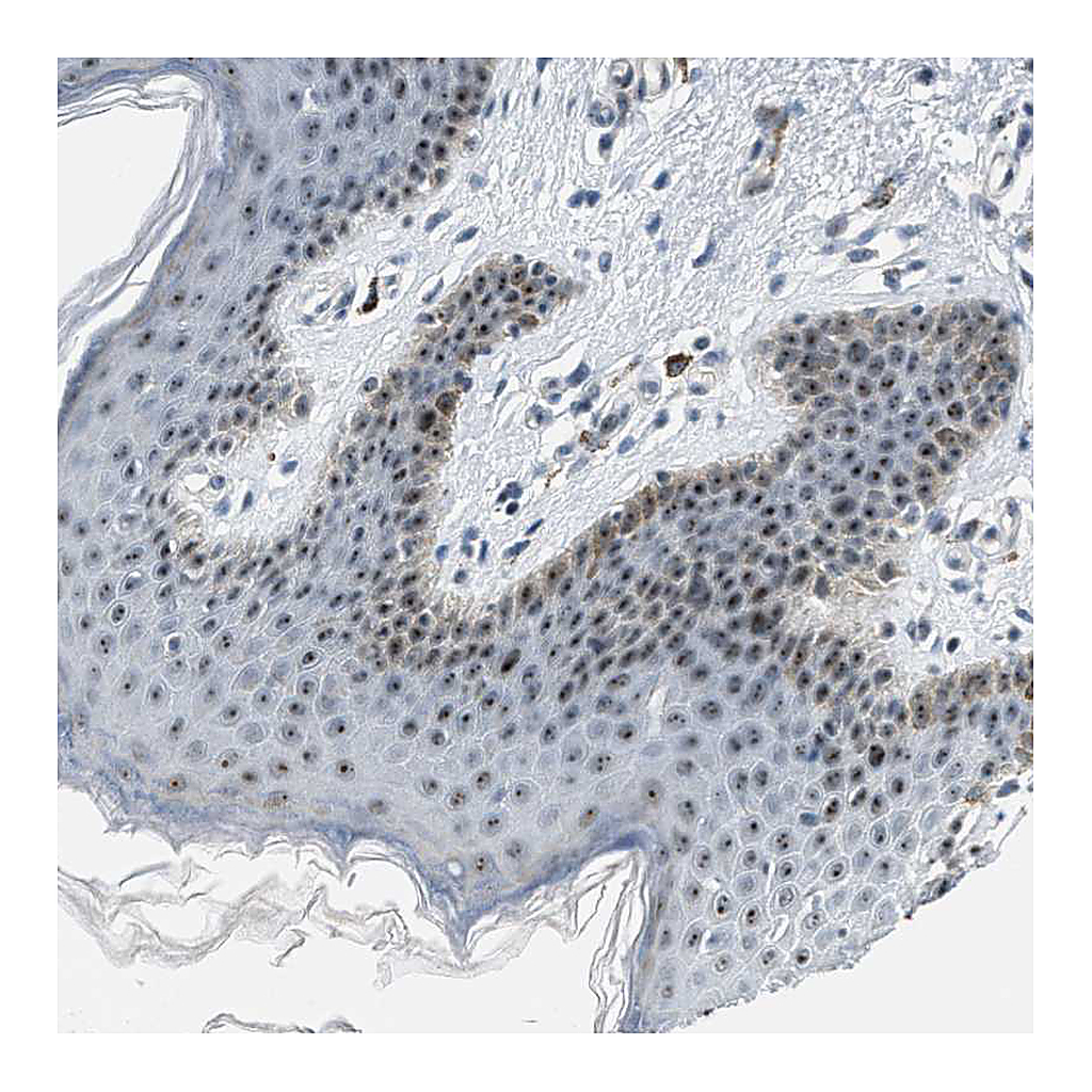 Atlas Antibodies Anti-DDX47 Antibody