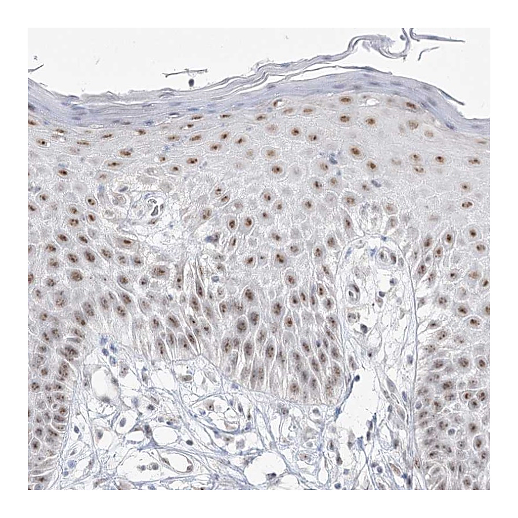 Atlas Antibodies Anti-DDX50 Antibody