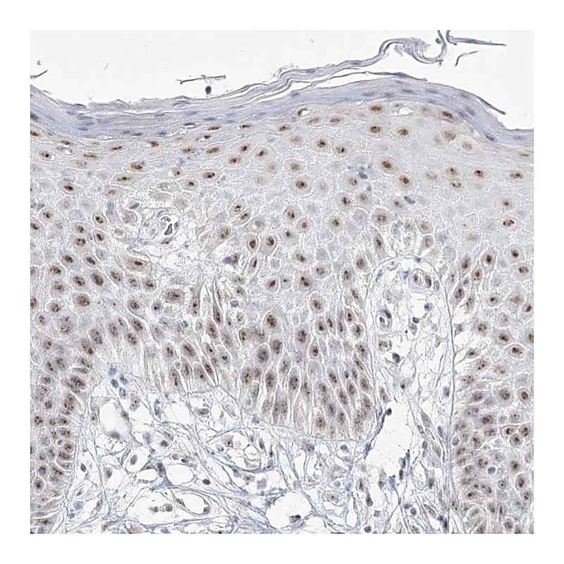 Atlas Antibodies Anti-DDX50 Antibody