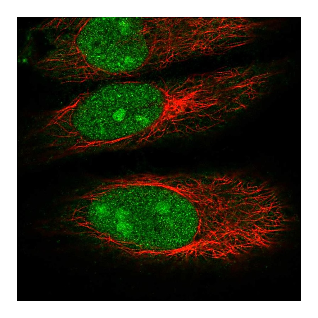 Atlas Antibodies Anti-DDX55 Antibody