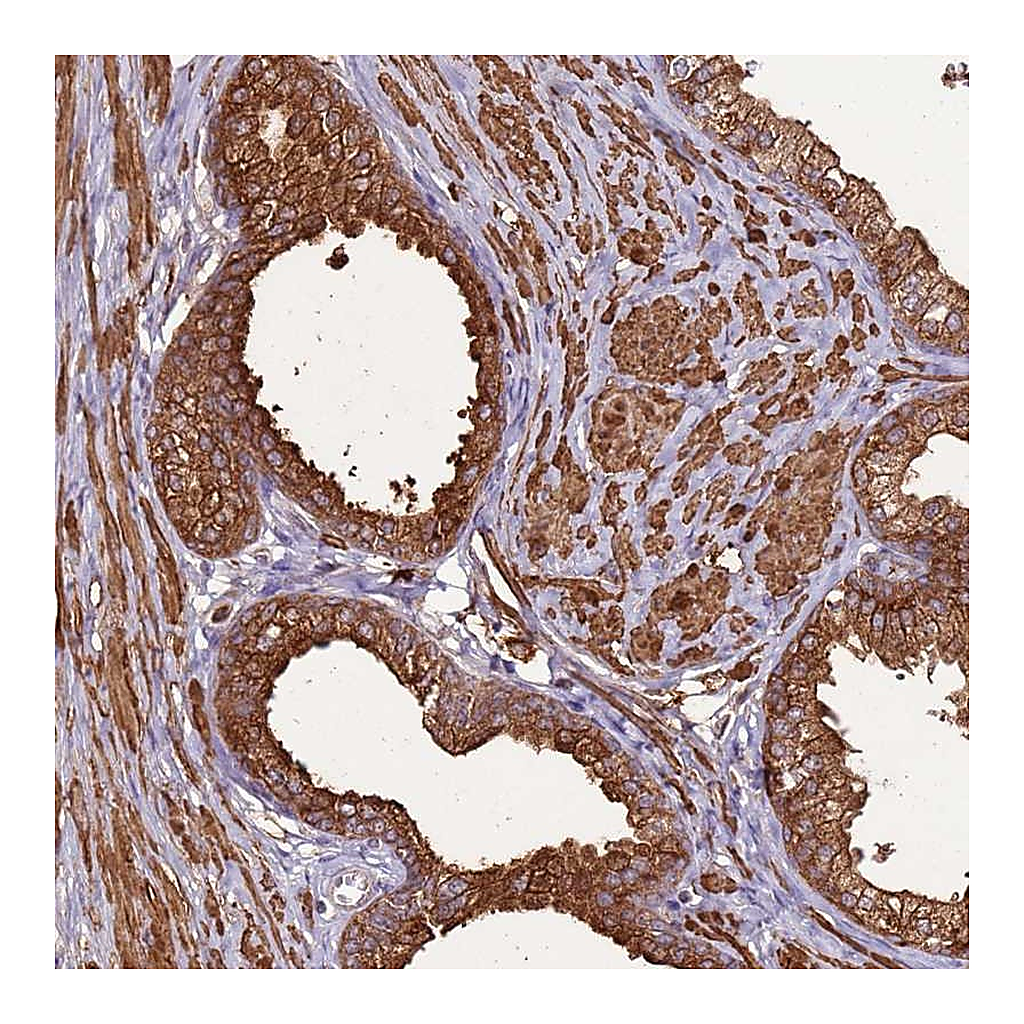 Atlas Antibodies Anti-DDX59 Antibody