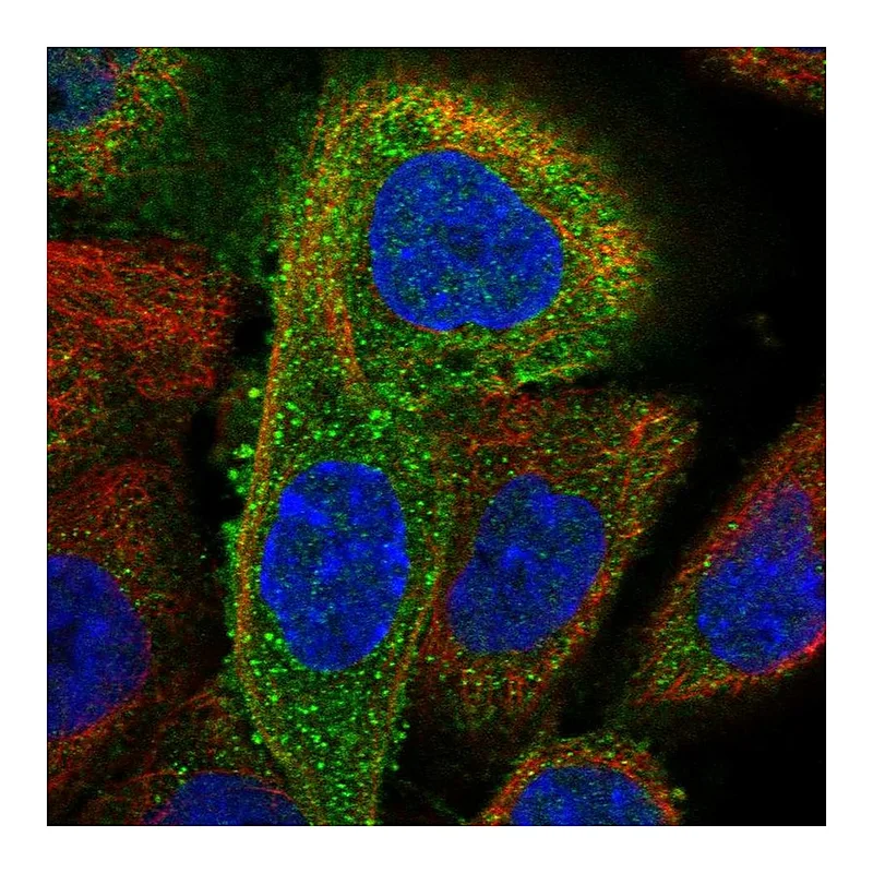 Atlas Antibodies Anti-DDX58 Antibody