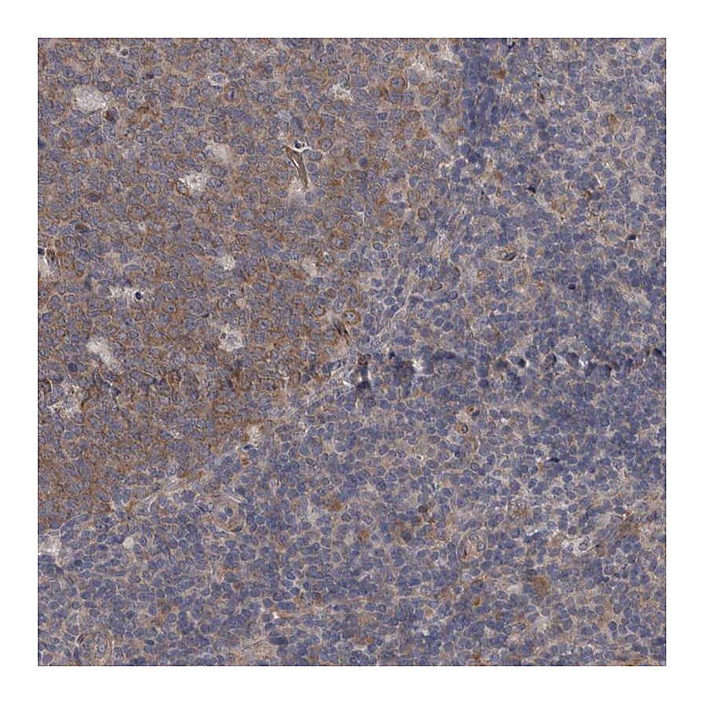 Atlas Antibodies Anti-DDX6 Antibody