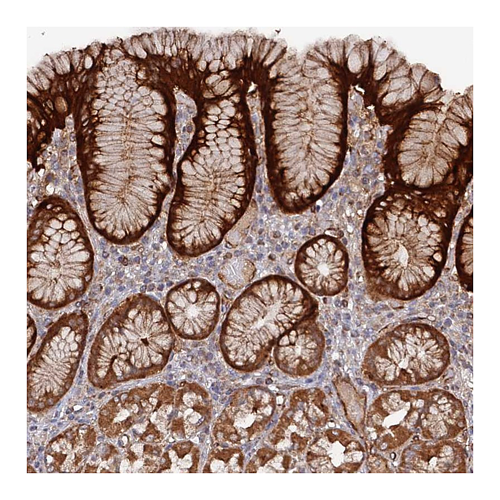 Atlas Antibodies Anti-DDX60 Antibody
