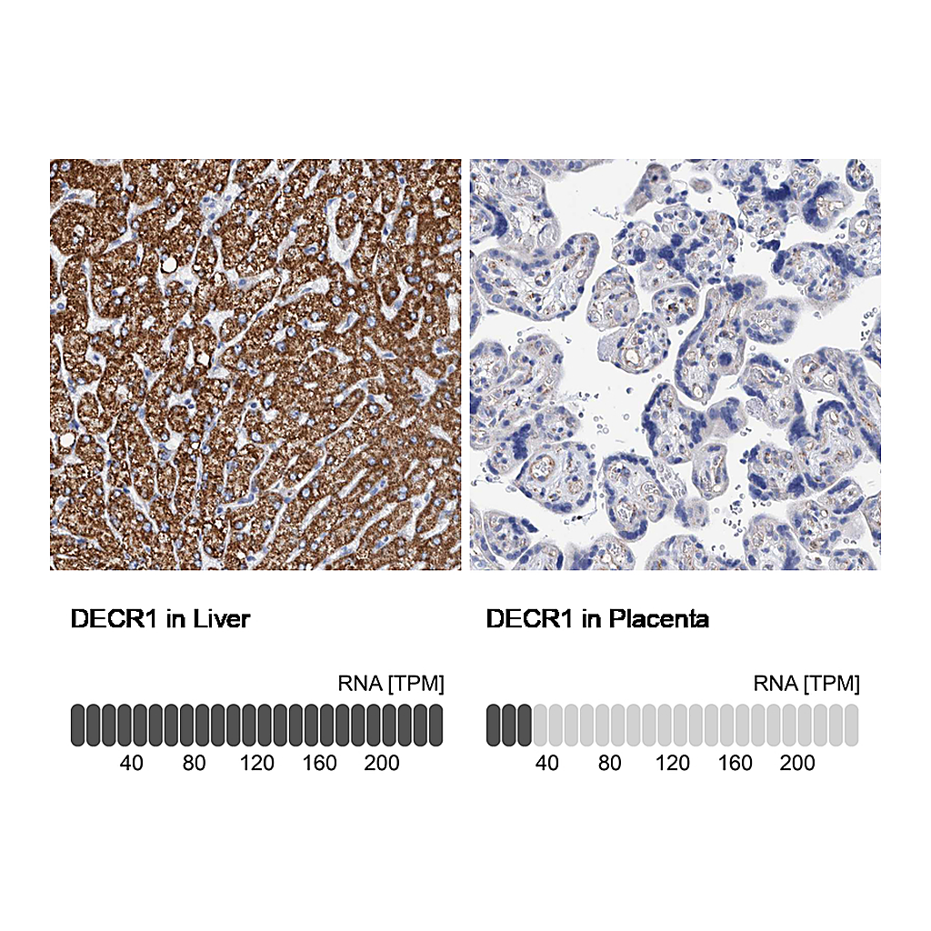 Atlas Antibodies Anti-DECR1 Antibody