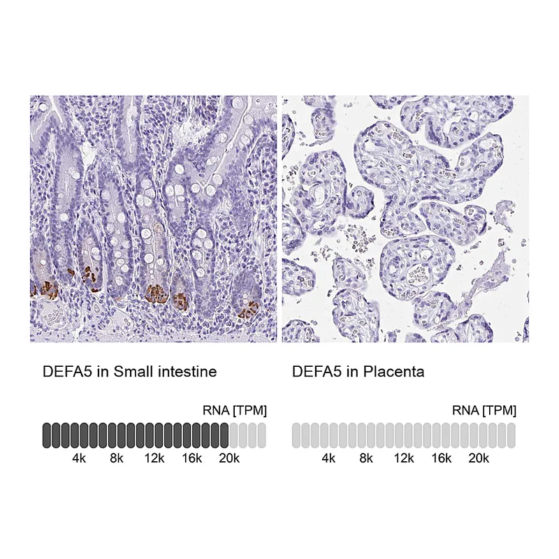 Atlas Antibodies Anti-DEFA5 Antibody