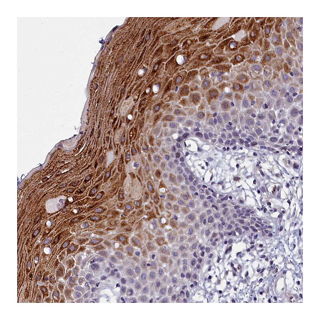 Atlas Antibodies Anti-DEFB108B Antibody