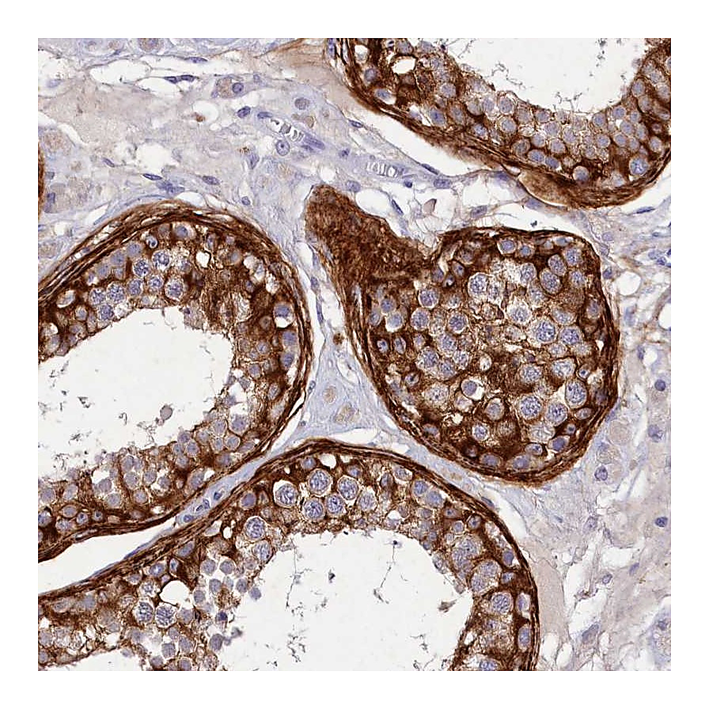 Atlas Antibodies Anti-DEFB119 Antibody
