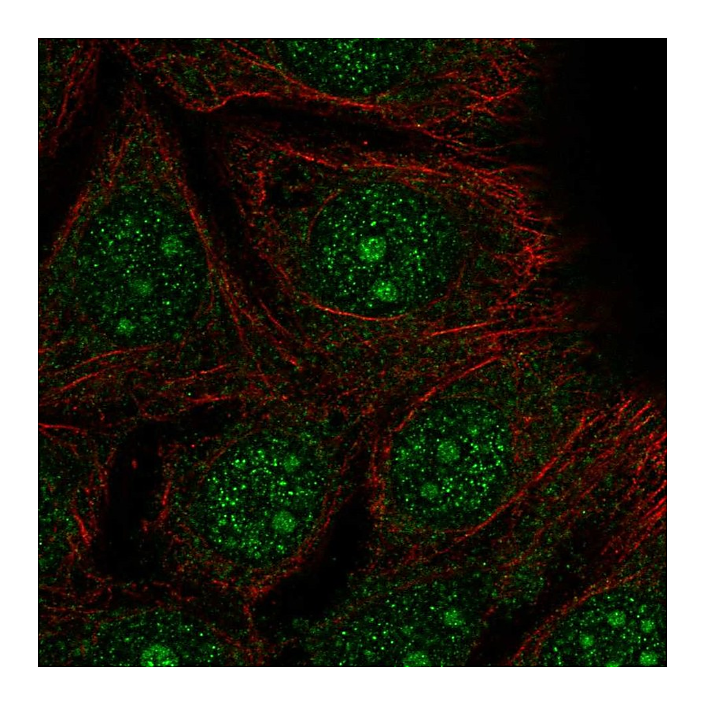 Atlas Antibodies Anti-DEGS2 Antibody
