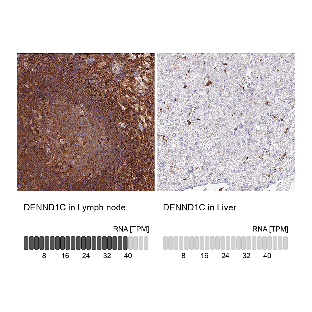 Atlas Antibodies Anti-DENND1C Antibody