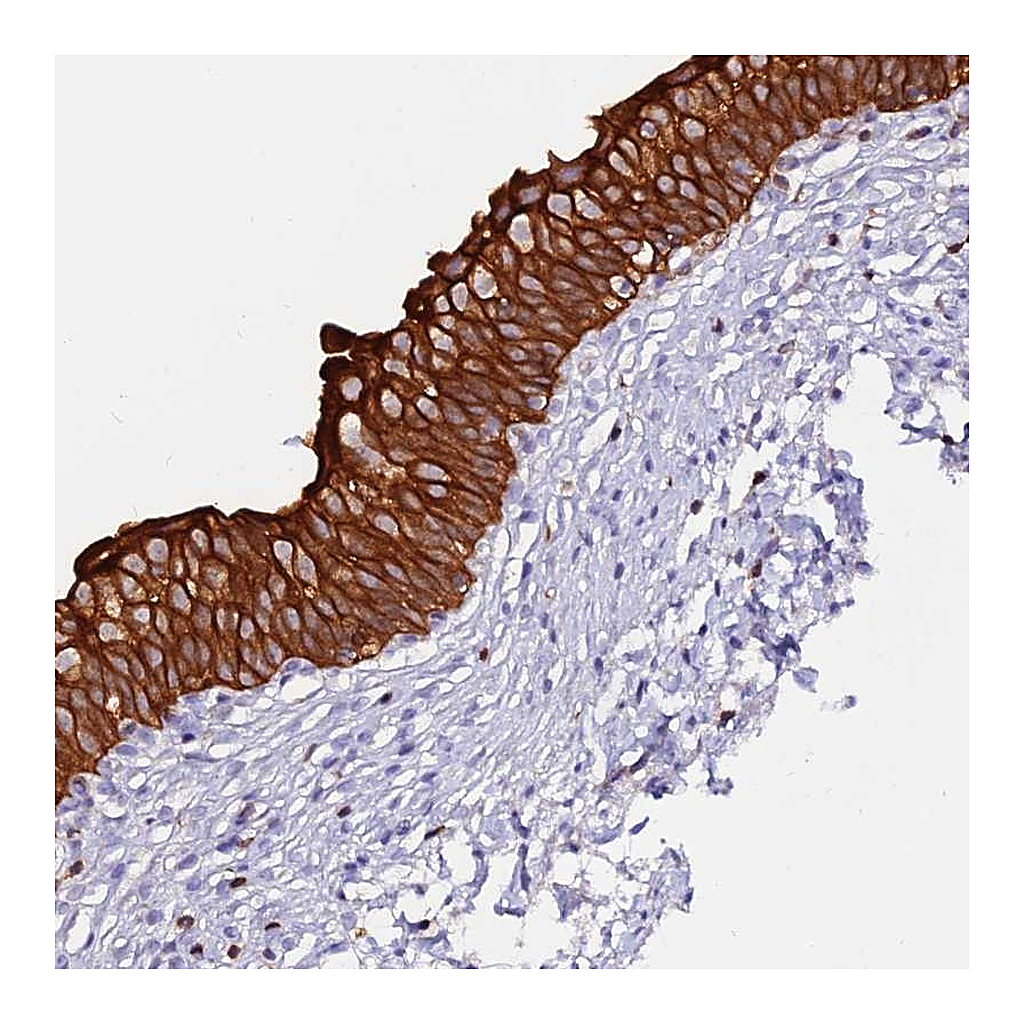 Atlas Antibodies Anti-DENND2D Antibody