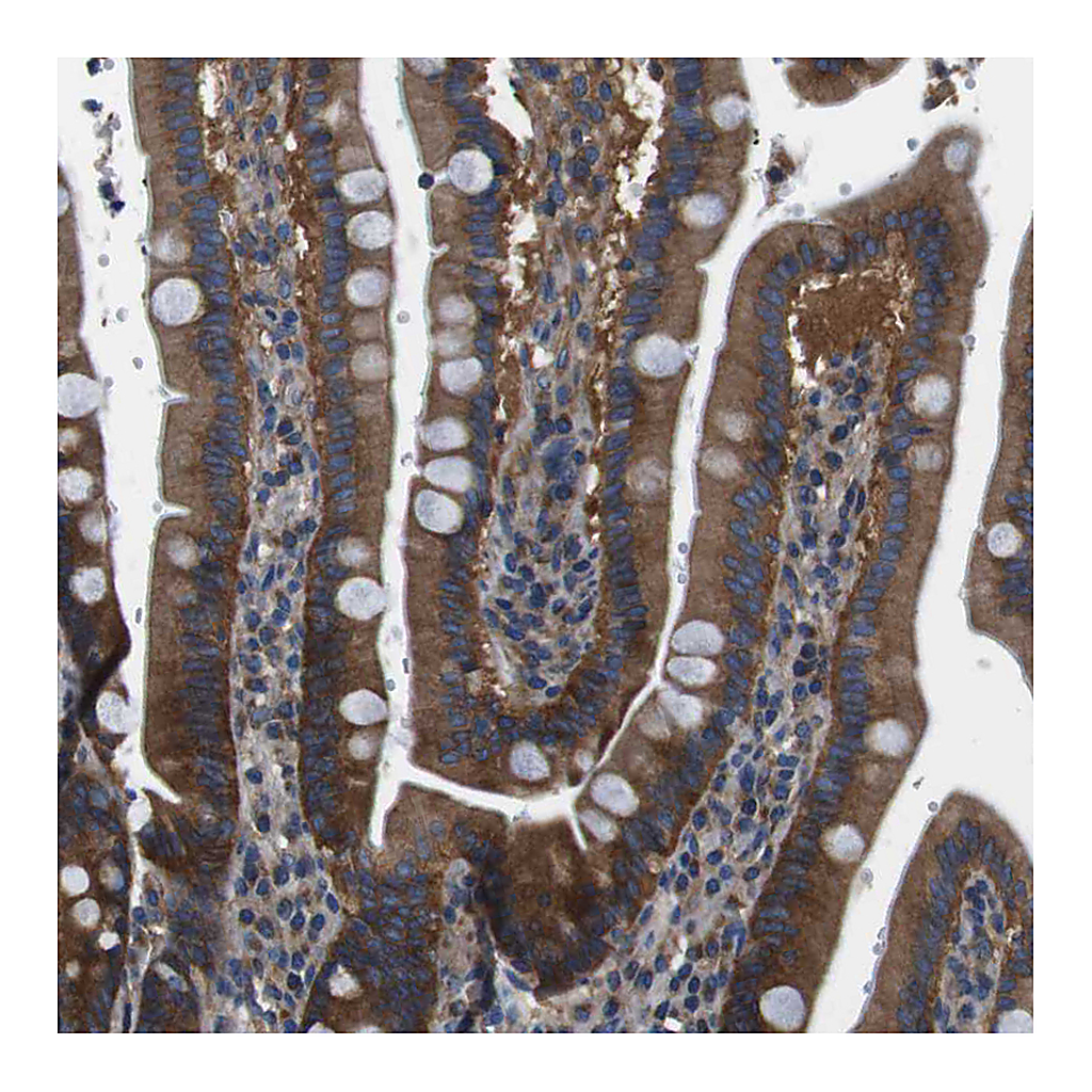 Atlas Antibodies Anti-DENND4C Antibody