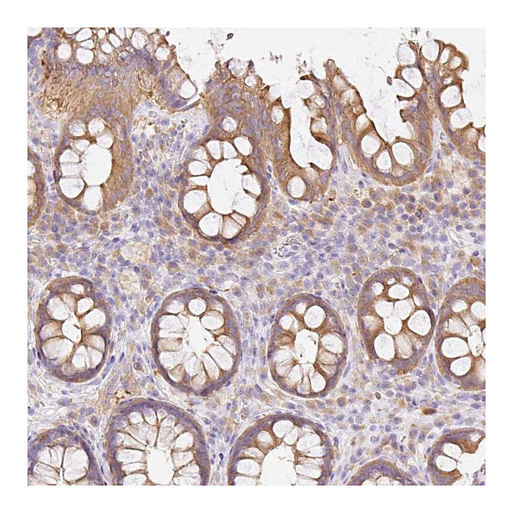 Atlas Antibodies Anti-DENND5A Antibody