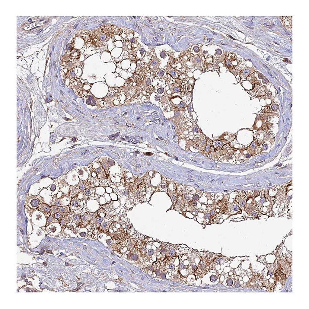 Atlas Antibodies Anti-DENND5B Antibody
