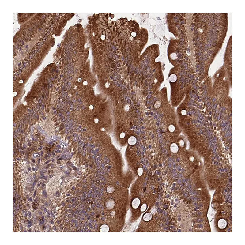 Atlas Antibodies Anti-DENND6A Antibody