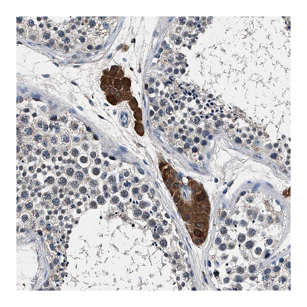 Atlas Antibodies Anti-DENND6B Antibody