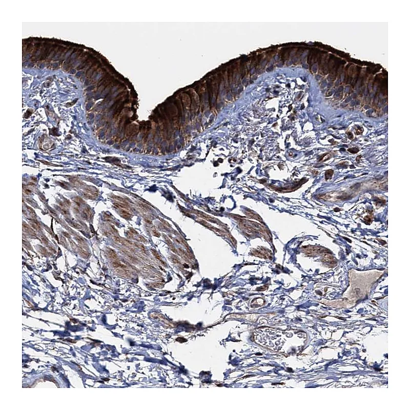 Atlas Antibodies Anti-DEPDC4 Antibody
