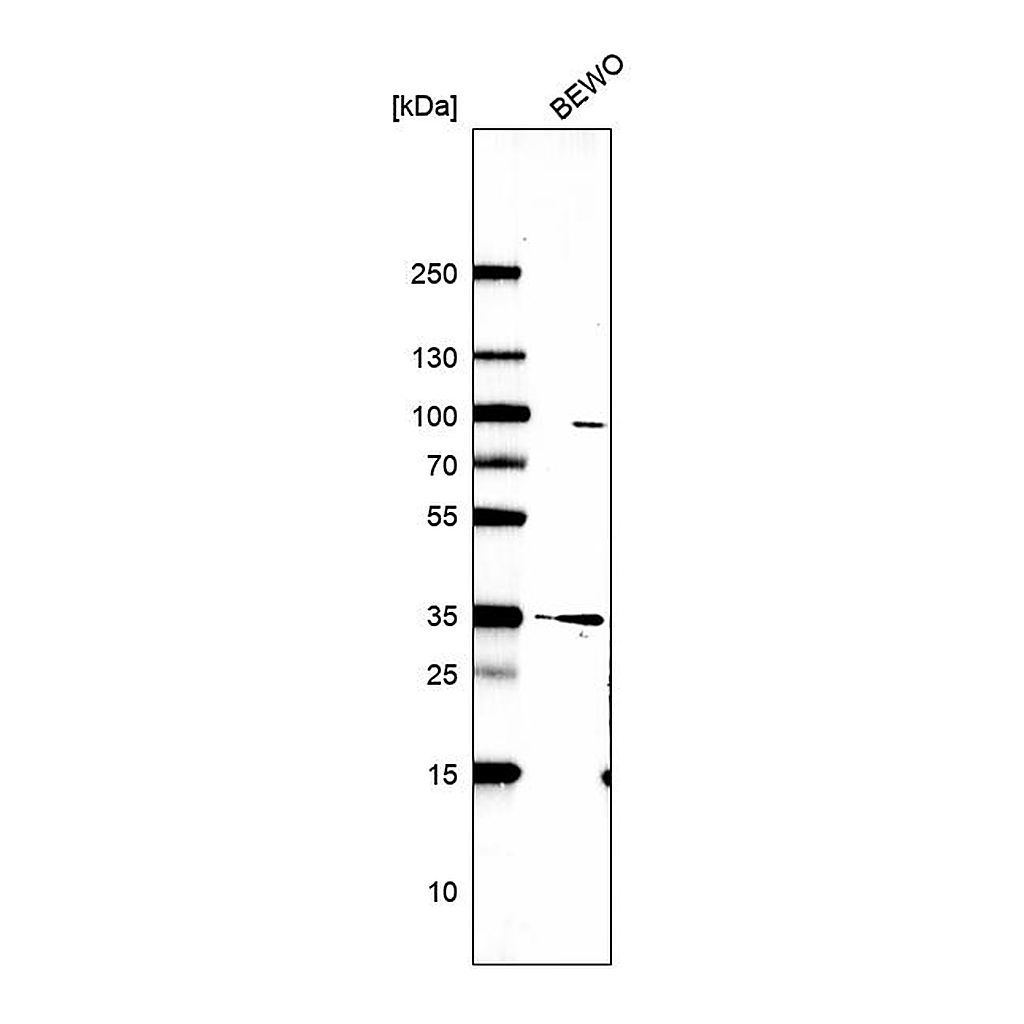 Atlas Antibodies Anti-DERA Antibody
