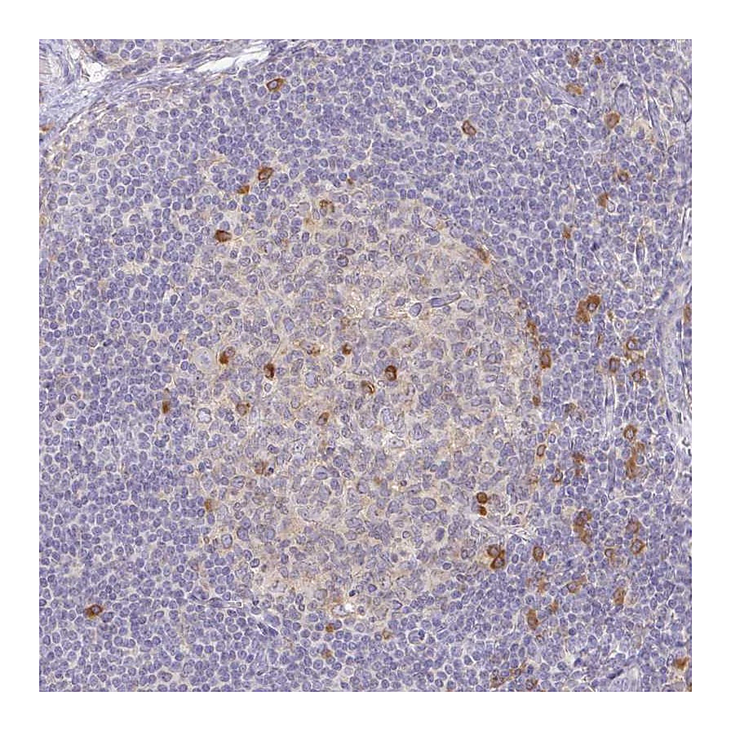Atlas Antibodies Anti-DERL2 Antibody
