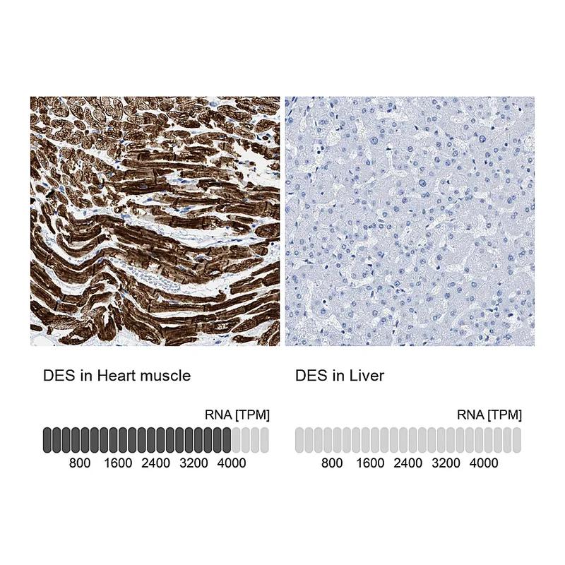 Atlas Antibodies Anti-DES Antibody