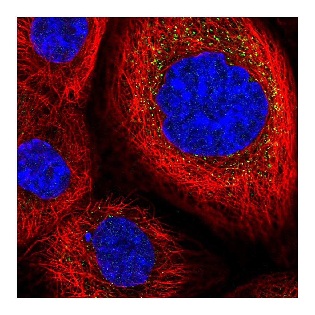 Atlas Antibodies Anti-DESI2 Antibody