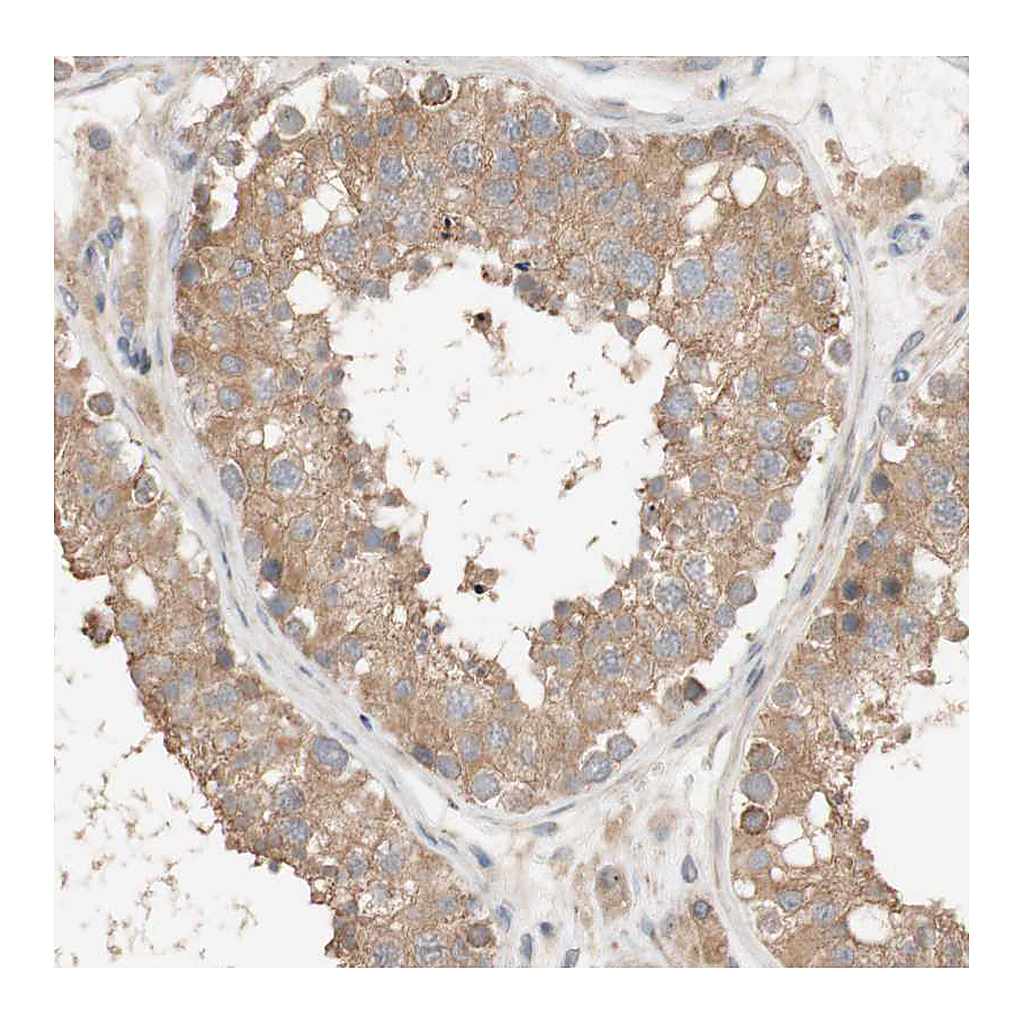 Atlas Antibodies Anti-DEUP1 Antibody