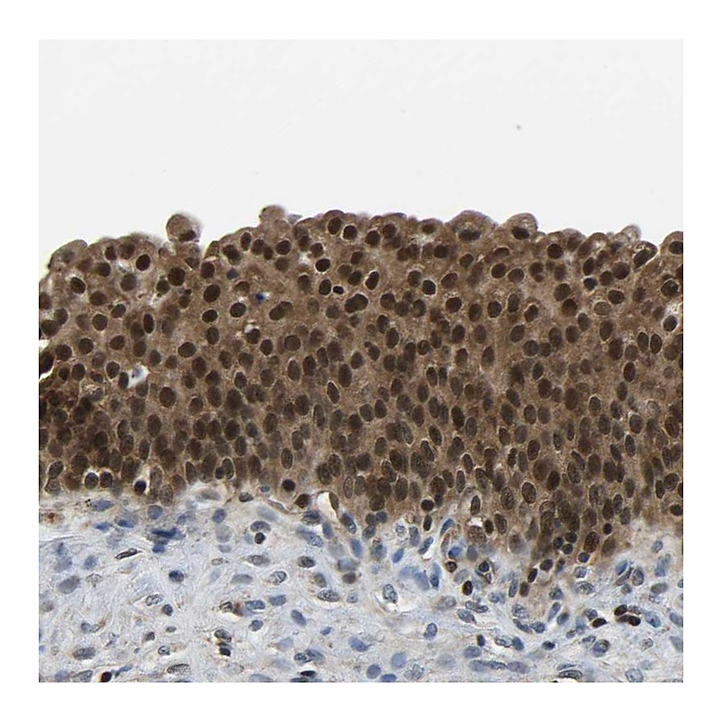 Atlas Antibodies Anti-DFFA Antibody