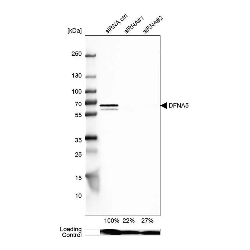 Atlas Antibodies Anti-DFNA5 Antibody