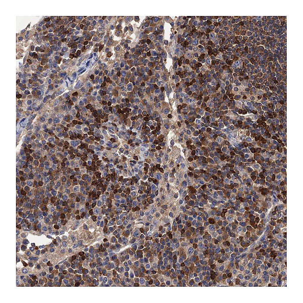 Atlas Antibodies Anti-DGKA Antibody