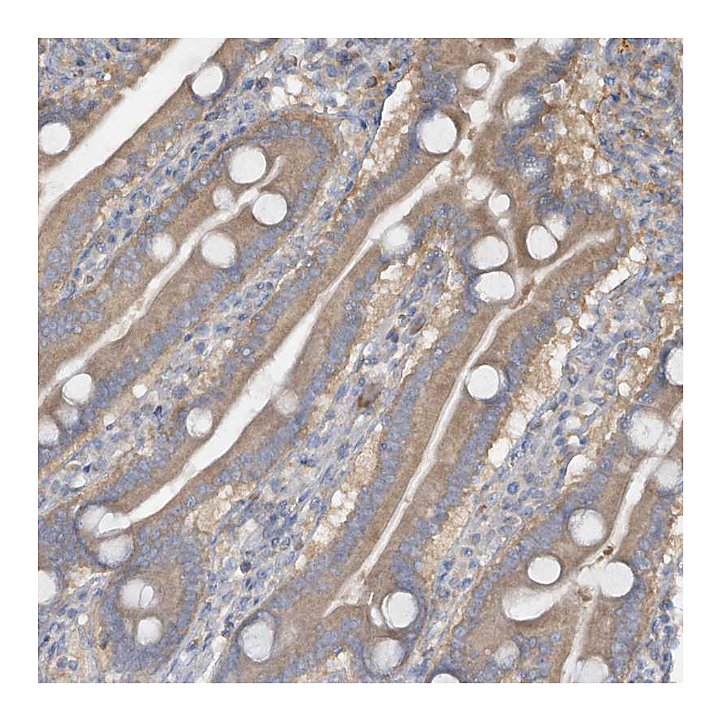 Atlas Antibodies Anti-DGKQ Antibody