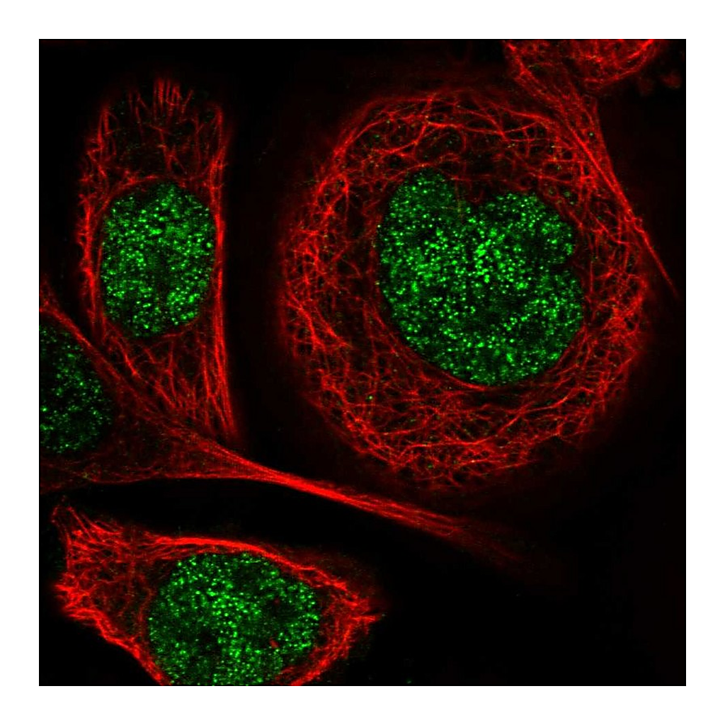 Atlas Antibodies Anti-DGKI Antibody